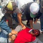Maestro guerrerense pierde un ojo tras enfrentamiento durante protesta de la CNTE en CDMX